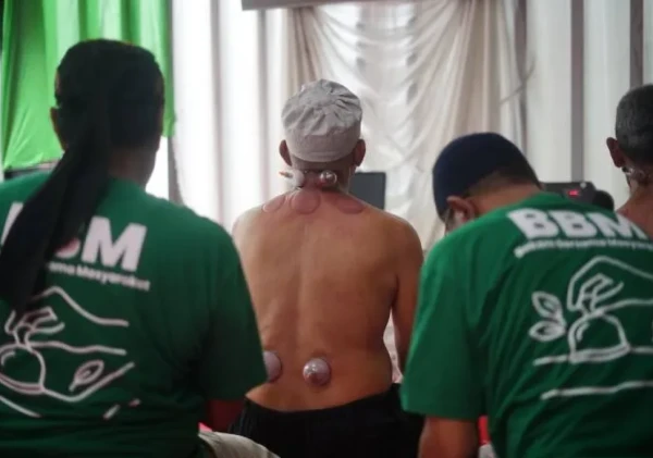 Pemkot Tangerang Apresiasi Bekam Bersama Masyarakat (BBM) Gratis di Cipadu