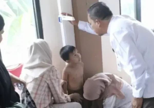 Pemkot Tangerang Intensifkan Upaya Penurunan Stunting melalui Skrining Balita